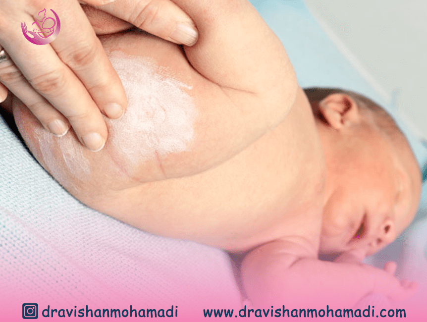 درمان های خانگی عفونت های قارچی در نوزادان