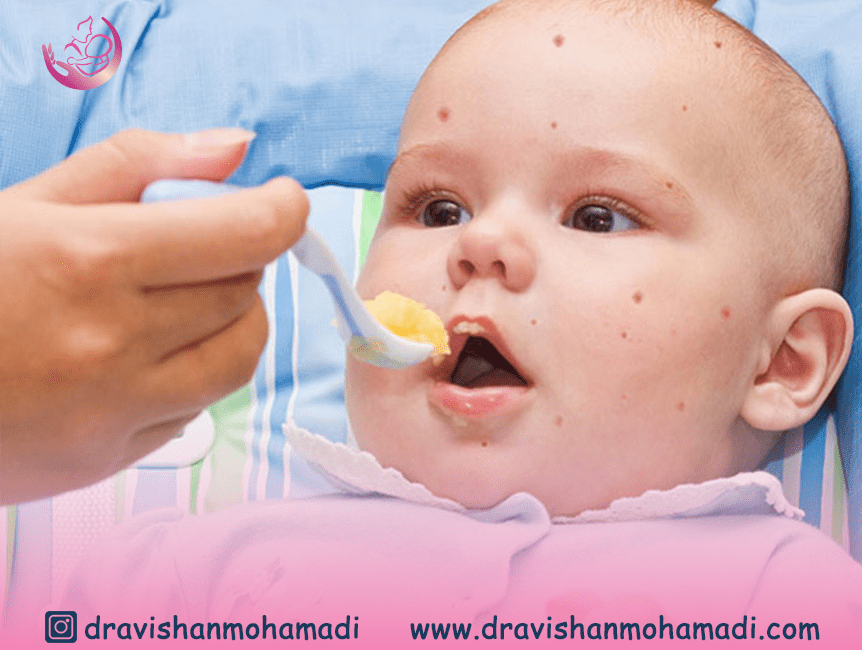 درمان آلرژی های غذایی در کودکان و نوزادان